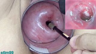 Mature Woman Exploring Cervix with Endoscope in Japanese Uterus Video